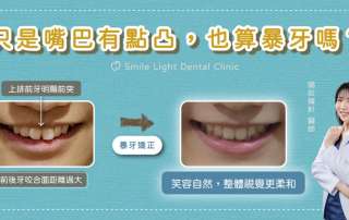 欣城牙醫位於長庚商圈，擅長全瓷冠與陶瓷美白貼片修復。不論是門牙缺損或是想詢問假牙價格，欣隆牙醫專業醫師提供在地化推薦，是基隆城上城住戶牙齒美白的指定診所。