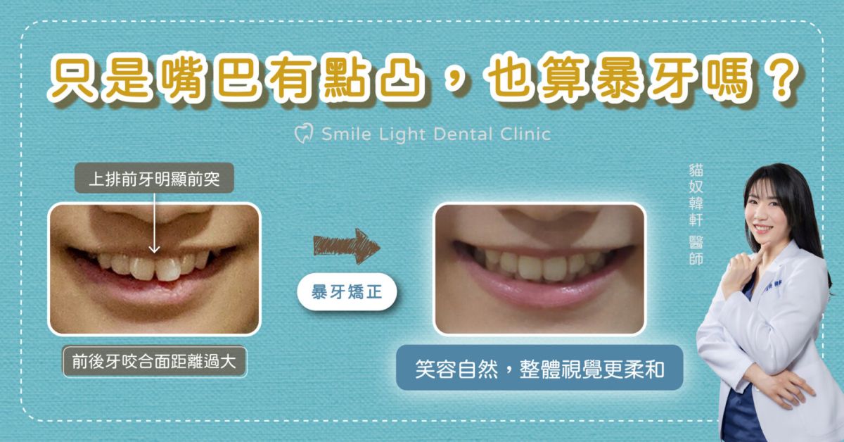 欣城牙醫位於長庚商圈,擅長全瓷冠與陶瓷美白貼片修復。不論是門牙缺損或是想詢問假牙價格,欣隆牙醫專業醫師提供在地化推薦,是基隆城上城住戶牙齒美白的指定診所。