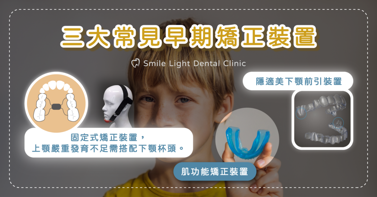 欣城牙醫與欣隆牙醫關心城上城小朋友的齒顎健康，提供兒童牙醫塗氟與溝隙封填服務。診所位於長庚商圈，環境親切，是您在基隆尋找固定家庭牙醫、定期洗牙與口腔檢查的最佳選擇。